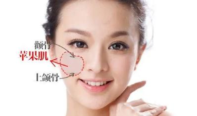 蘋果肌好看還是不好看？女生有蘋果肌好看嗎？