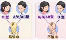 懷孕期間怎么查胎兒有沒(méi)有溶血